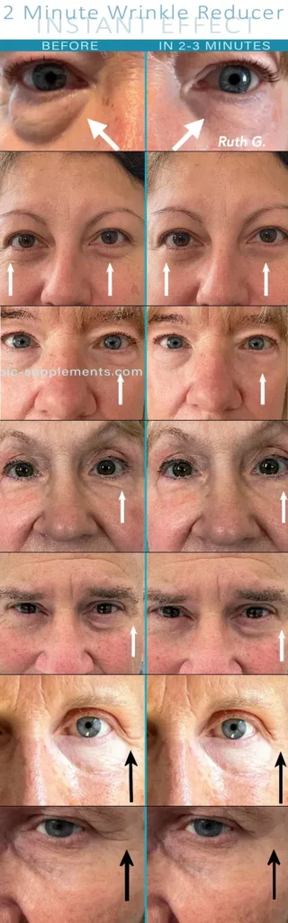 Efekty klientek przed i po, podczas stosowania kremu 2 minute wrinkle reducer